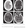 Lange Clinical Neurology and Neuroanatomy: A Localization-Based Approach2017