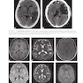 Lange Clinical Neurology and Neuroanatomy: A Localization-Based Approach2017