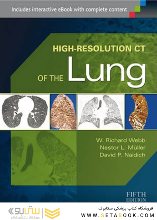 High-Resolution CT of the Lung Fifth Edition2014 سی تی ریه با وضوح بالا