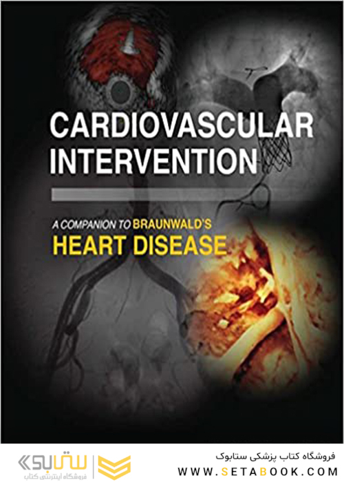 Cardiovascular Intervention, 1st Edition 2015