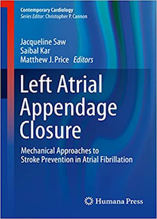 عکس Left Atrial Appendage Closure: Mechanical Approaches to Stroke Prevention in Atrial Fibrillation2016 بسته شدن زائده دهلیز چپ: رویکردهای مکانیکی پیشگیری از سکته مغزی در فیبریلاسیون دهلیزی