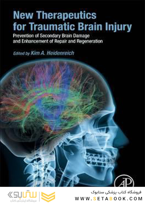 New Therapeutics for Traumatic Brain Injury, 1st Edition 2017