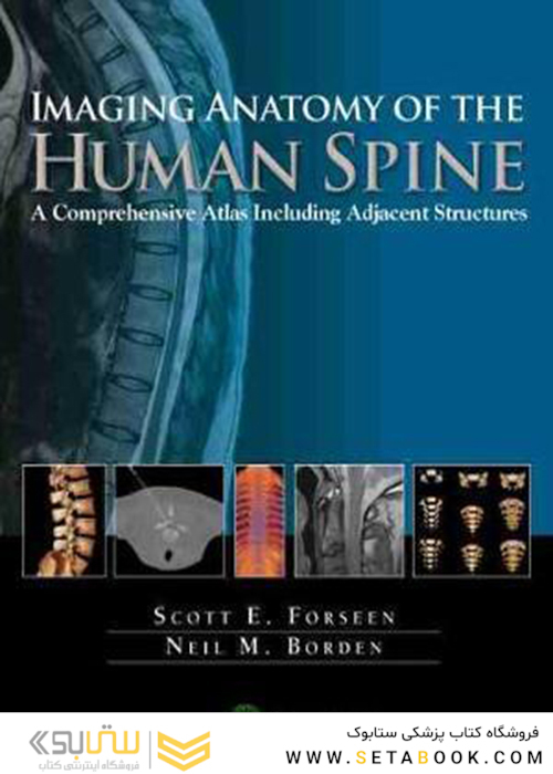Imaging Anatomy of the Human Spine2016 تصویربرداری آناتومی ستون فقرات انسان