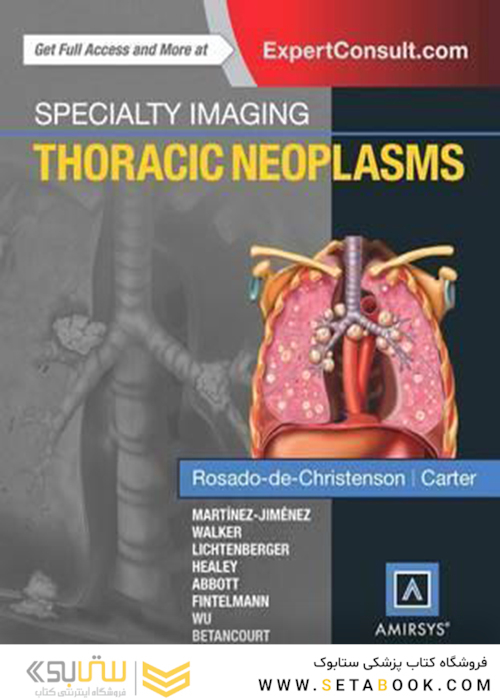 Specialty Imaging: Thoracic Neoplasms 1st Edition2015 تصویربرداری تخصصی: نئوپلاسم های قفسه سینه