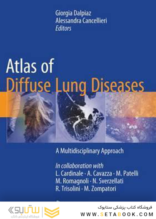 Atlas of Diffuse Lung Diseases, 1st Edition 2017