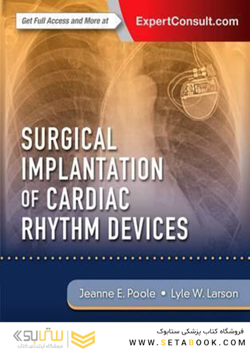 Surgical Implantation of Cardiac Rhythm Devices, 1e Edition2017 کاشت جراحی دستگاه های ریتم قلب