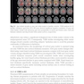 Neuroimaging Diagnosis for Alzheimer’s Disease and Other Dementias, 1st Edition2017