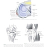 Noyes’ Knee Disorders: Surgery, Rehabilitation, Clinical Outcomes, 2nd Edition 2016