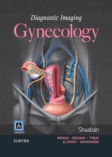 عکس Diagnostic Imaging: Gynecology, 2th Edition2015 تصویربرداری تشخیصی: زنان