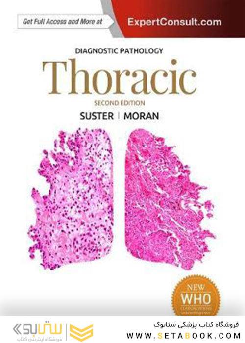 Diagnostic Pathology: Thoracic, 2nd Edition2017 آسیب شناسی تشخیصی: قفسه سینه