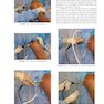 Gartsman’s Shoulder Arthroscopy 3rd Edition2018