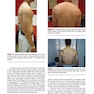 Disorders of the Shoulder: Sports Injuries -Vol2- 3E 2013