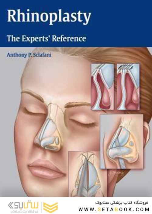 Rhinoplasty: The Experts’ Reference 1st Edition2015 جراحی زیبایی بینی: مرجع متخصصان