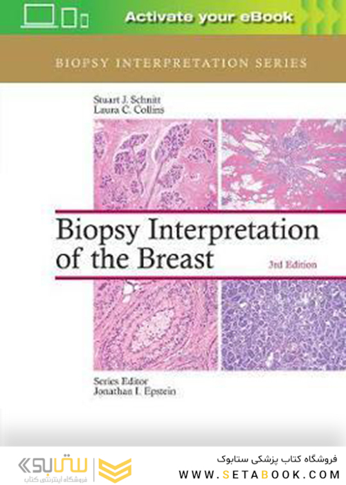 Biopsy Interpretation of the Breast, Third Edition 2017