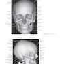 Sectional Anatomy for Imaging Professionals 4th Edition2018