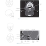 Sectional Anatomy for Imaging Professionals 4th Edition2018