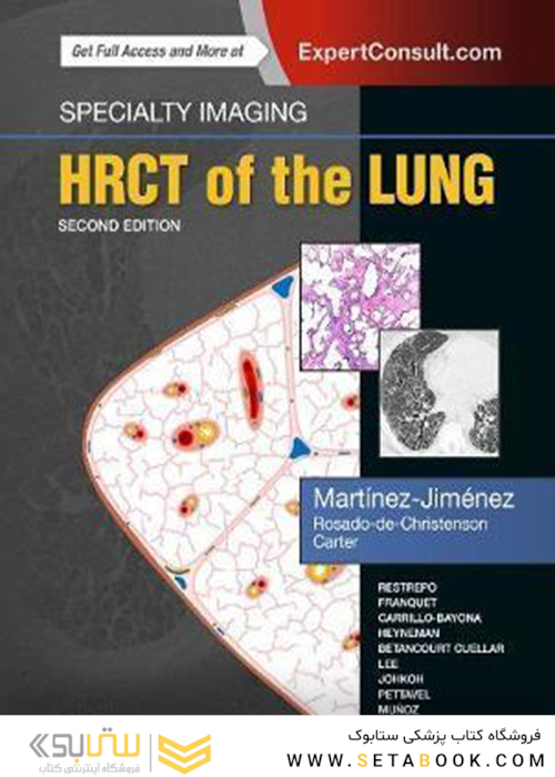 Specialty Imaging: HRCT of the Lung 2nd Edition2017 تصویربرداری تخصصی: اچ آر سی تی ریه