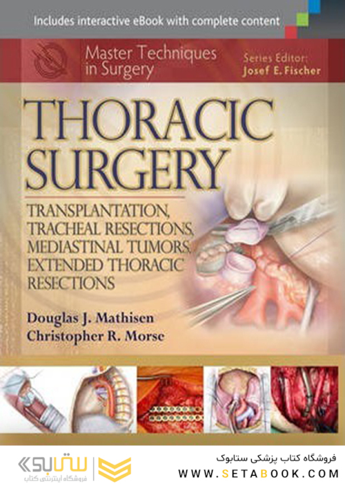 Master Techniques in Surgery: Thoracic Surgery2014 تکنیک های جراحی قفسه سینه