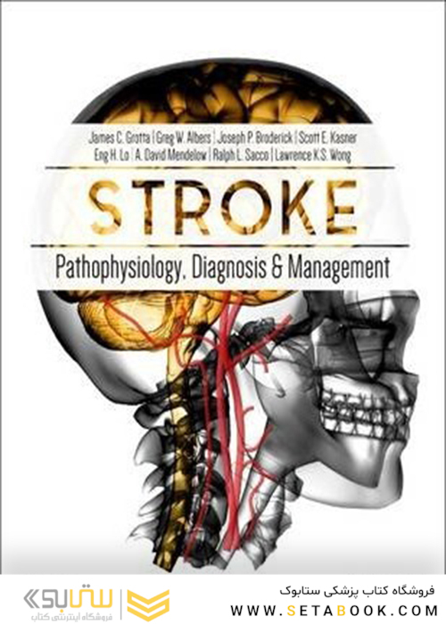 Stroke: Pathophysiology, Diagnosis, and Management 6th Edition2015 سکته مغزی: پاتوفیزیولوژی ، تشخیص و مدیریت