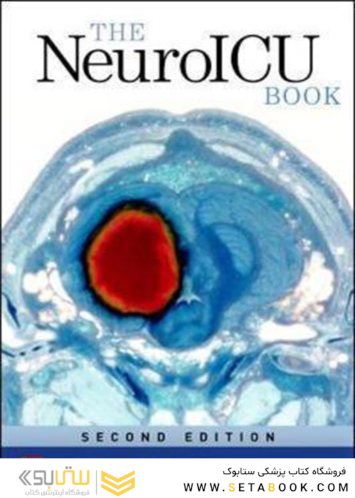 The NeuroICU Book, 2nd Edition2017