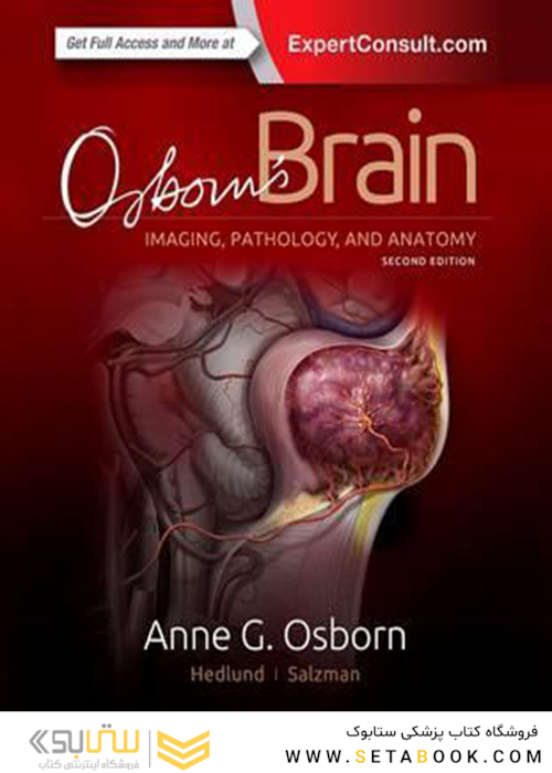 Osborn’s Brain, 2nd Edition2017
