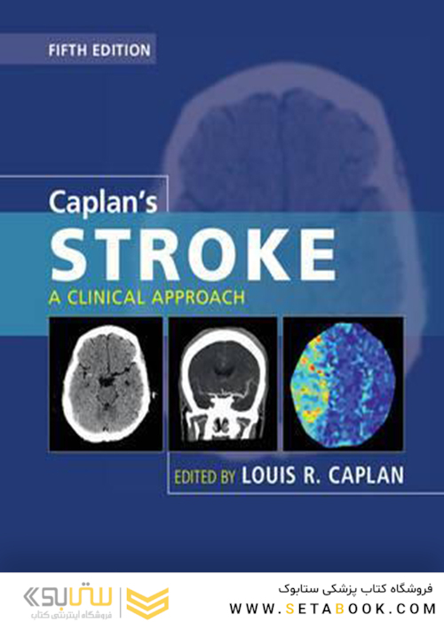 Caplan’s Stroke: A Clinical Approach 5th Edition2016 سکته مغزی: یک رویکرد بالینی