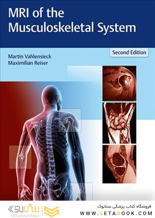 MRI of the Musculoskeletal System, 2nd Edition2018 ام آر آی سیستم اسکلتی عضلانی