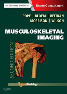 عکس Musculoskeletal Imaging (Expert Radiology) 2nd Edition2014 تصویربرداری اسکلتی - عضلانی (متخصص رادیولوژی)