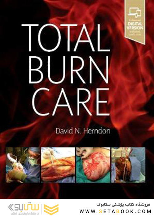 Total Burn Care 5th Edition 2017