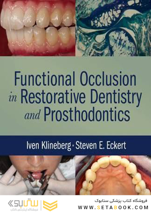 Functional Occlusion in Restorative Dentistry and Prosthodontics2015 انسداد عملکردی در دندانپزشکی ترمیمی و پروتزهای دندانی