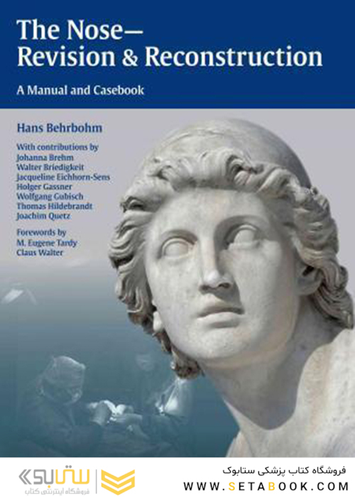 The Nose – Revision and Reconstruction, 1st Edition2015 بینی - بازنگری و بازسازی
