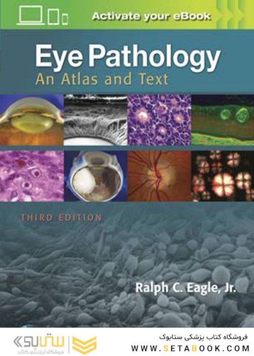Eye Pathology, 3th Edition2016 آسیب شناسی چشم