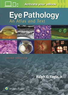 عکس Eye Pathology, 3th Edition2016 آسیب شناسی چشم