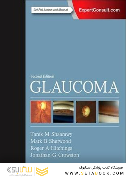 Glaucoma: 2-Volume Set 2nd Edition2014 گلوکوم: مجموعه 2 جلدی