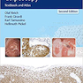 Burghardt’s Primary Care Colposcopy Textbook and Atlas, 2th Edition2017 اطلس کولپوسکوپی مراقبت های اولیه