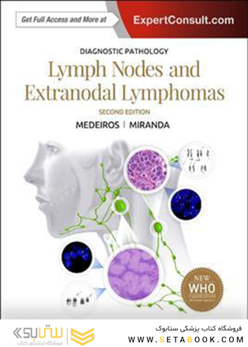 Diagnostic Pathology: Lymph Nodes and Extranodal Lymphomas 2nd Edition2017 آسیب شناسی تشخیصی: گره های لنفاوی و لنفوم های خارج از رحم