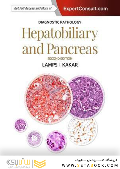 Diagnostic Pathology: Hepatobiliary and Pancreas 2nd Edition2016 آسیب شناسی تشخیصی: کبد و صفراوی