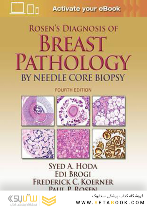 Rosen’s Diagnosis of Breast Pathology by Needle Core Biopsy 4th Edition2017 تشخیص پاتولوژی پستان توسط بیوپسی هسته سوزنی