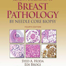 Rosen’s Diagnosis of Breast Pathology by Needle Core Biopsy 4th Edition2017 تشخیص پاتولوژی پستان توسط بیوپسی هسته سوزنی