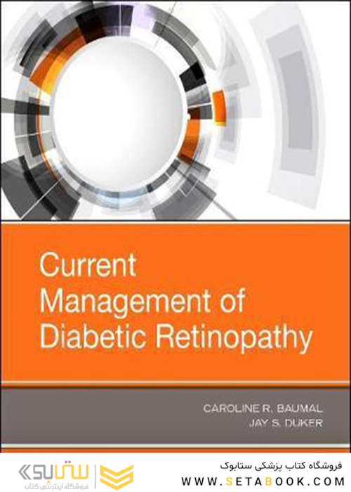 Current Management of Diabetic Retinopathy 1st Edition2017 مدیریت فعلی رتینوپاتی دیابتی