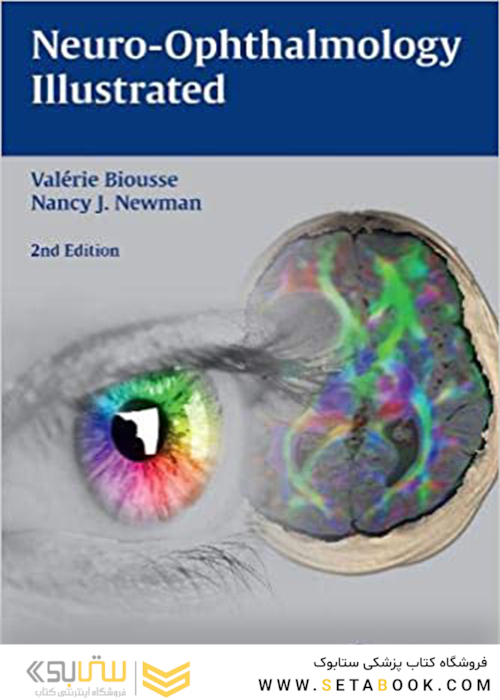 Neuro-Ophthalmology Illustrated 2nd Edition2015 چشم پزشکی مصور