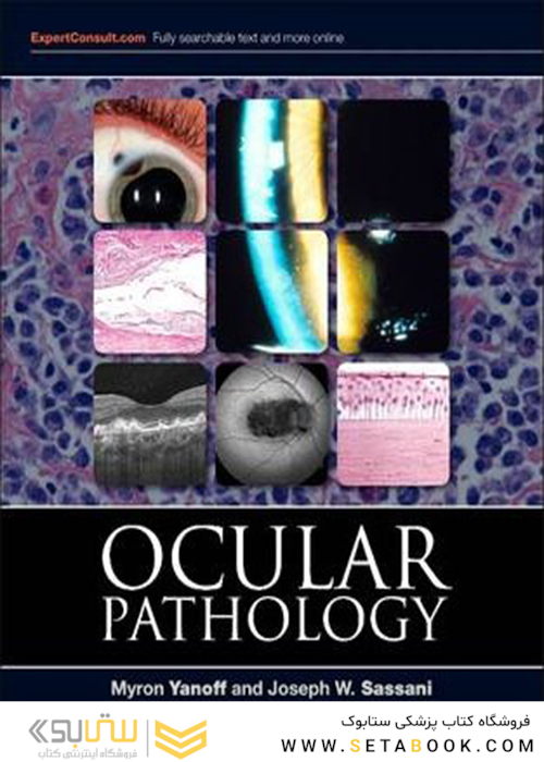 Ocular Pathology, 7th Edition2014 آسیب شناسی چشم