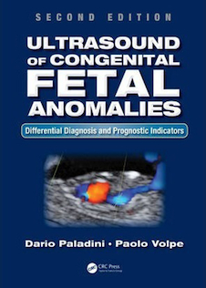 عکس Ultrasound of Congenital Fetal Anomalies 2nd Edition2014