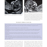 Ultrasound of Congenital Fetal Anomalies 2nd Edition2014