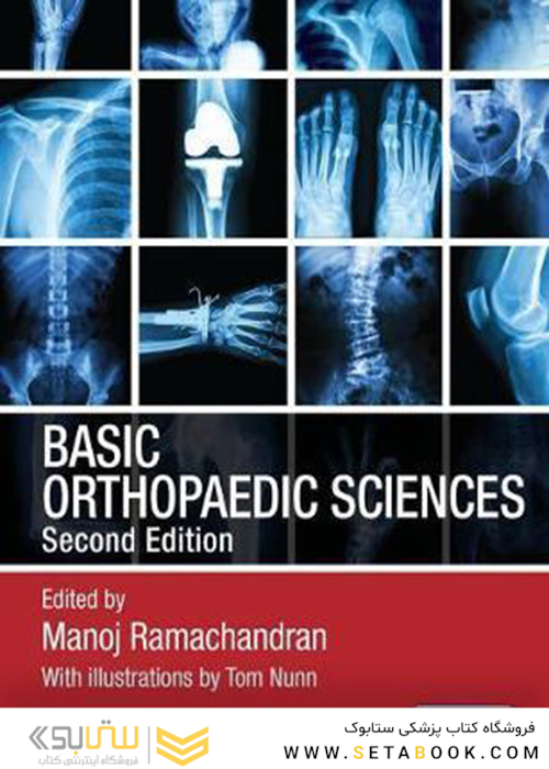 Basic Orthopaedic Sciences, 2nd Edition 2017