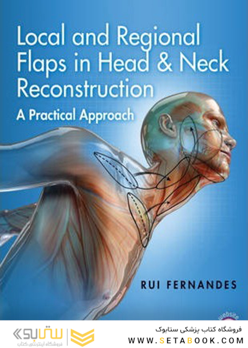Local and Regional Flaps in Head and Neck Reconstruction2017