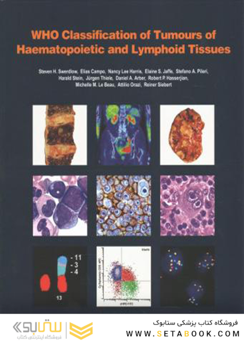 WHO Classification of Tumours of Haematopoietic and Lymphoid Tissues2017