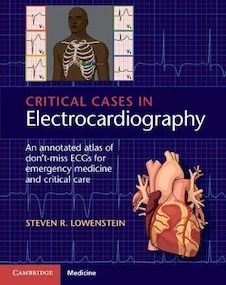 عکس Critical Cases in Electrocardiography, 1st Edition2020 موارد بحرانی در الکتروکاردیوگرافی