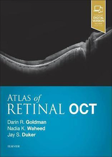 عکس Atlas of Retinal OCT: Optical Coherence Tomography 1st Edition2018 اطلس توموگرافی انسجام نوری شبکیه