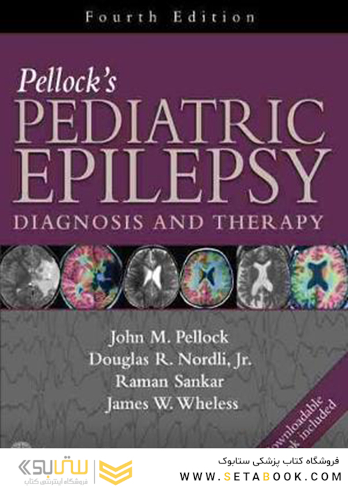 Pellock’s Pediatric Epilepsy, 4th Edition2016